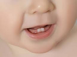 dent poussee dentaire de bebe comment soulager la douleur vite naturellement avec des huiles essentielles astuce grand mere bio