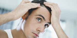 Comment lutter contre la chute des cheveux avec des huiles essentielles ? perte de cheveux remèdes grand mère naturelle. Complément alimentaire pour faire pousser les cheveux